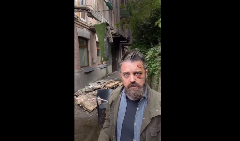 A balcony collapsed in Kyiv, an American director was injured: an expert explained how the capital was brought to a communal disaster
