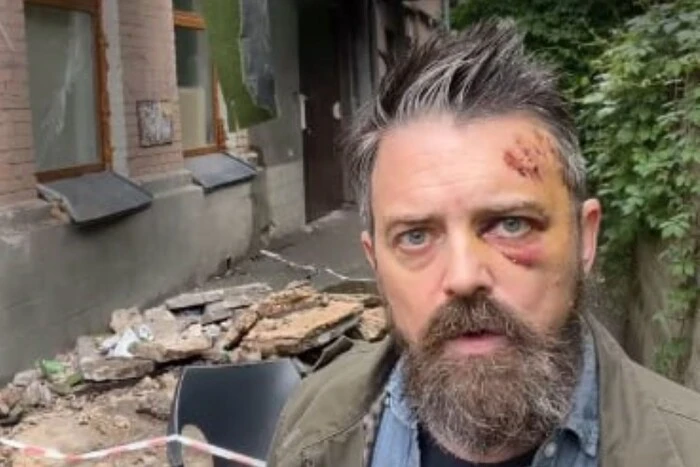 Amerykanin spadł razem z balkonem w Kijowie (wideo)