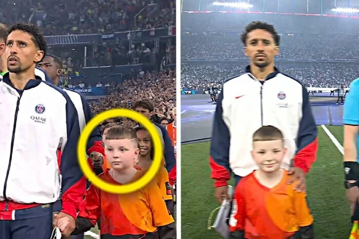 Young Ukrainian who lost a leg to cancer stepped onto the field with players before the Champions League final